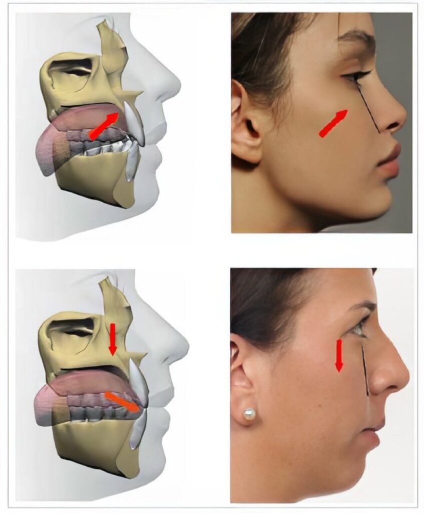 Mewing 101: A Complete Guide to the TikTok Facial Transformation Trend 3 Mewing